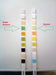 Urine stick with sugar/glucose and a normal stick
